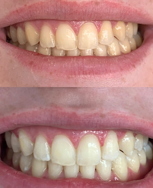 Foto 2 de Dra. Leticia Pascotto - Dentista Clínica Geral e Estética