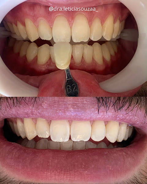 Foto 3 de Dra. Letícia Souza / Dentista
