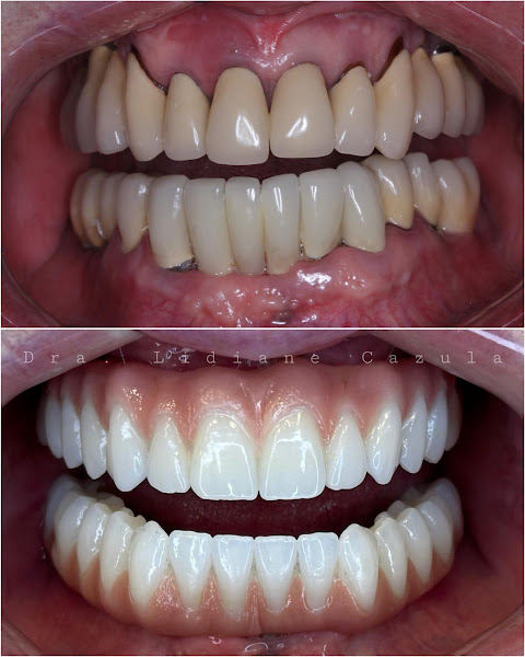 Foto 2 de Dra. Lidiane e Dr. Gabriel. Cazula Odontologia DESDE 2012. Unid: 2. Dentista Botox Invisalign Implante Aparelho