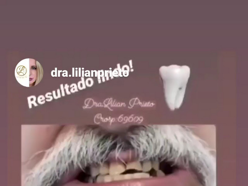 Dra Lilian Arevalo Prieto (Cirurgiã-dentista)
