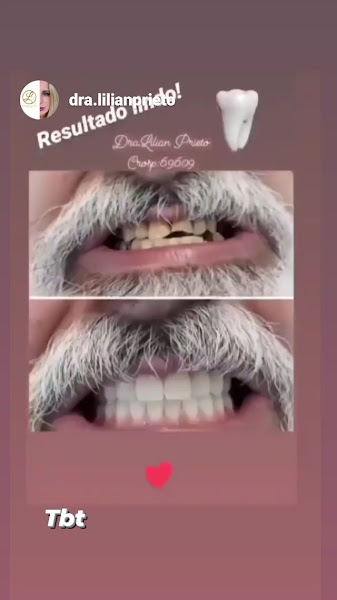 Foto 2 de Dra Lilian Arevalo Prieto (Cirurgiã-dentista)