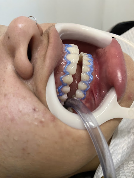 Foto 3 de Dra. Lilian Carlos - Dentista Usp