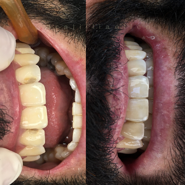Foto 3 de Dra. Lillia Ellen - Odontologia Estética e Reabilitadora.