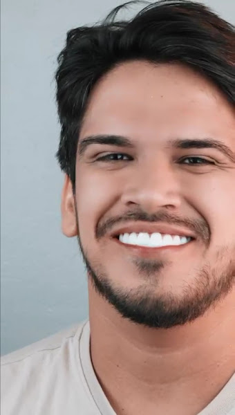 Foto 3 de Dra. Lilly Medeiros Dentista Especialista em Lentes em resina