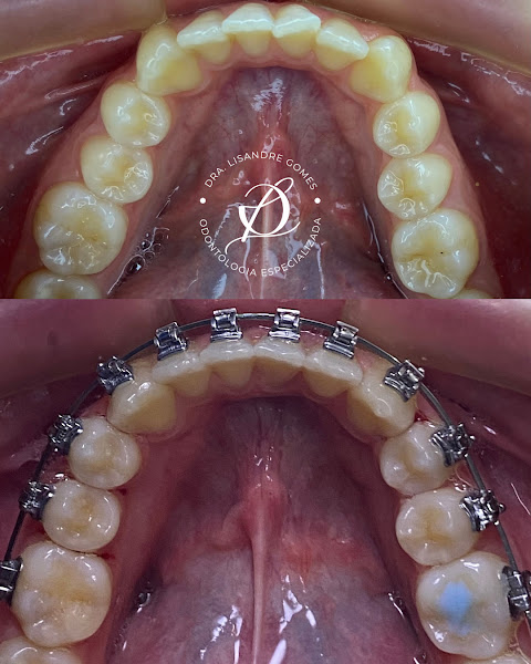 Foto 2 de Dra Lisandre Gomes - Odontologia Especializada