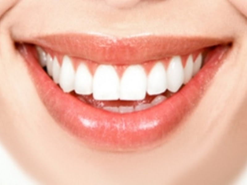 Foto 9 de Dra Livia : Há mais de 20 anos cuidando de Sorrisos com saúde, estética e excelência. Agende sua avaliação! 💎