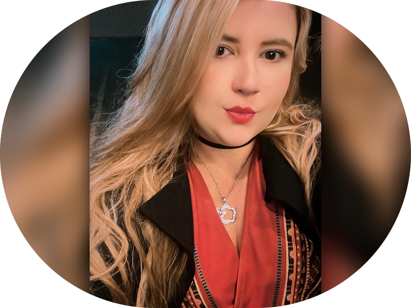 Foto 3 de Dra. Lohayne Ferrari - Facetas de resina em Bauru