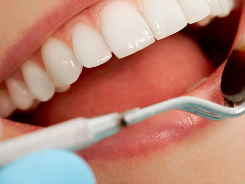 Foto 3 de Dra. Lorena Belchior Cirurgiã Dentista