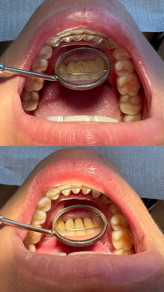Foto 3 de Dra Lorena Moraes | Dentista em Franca