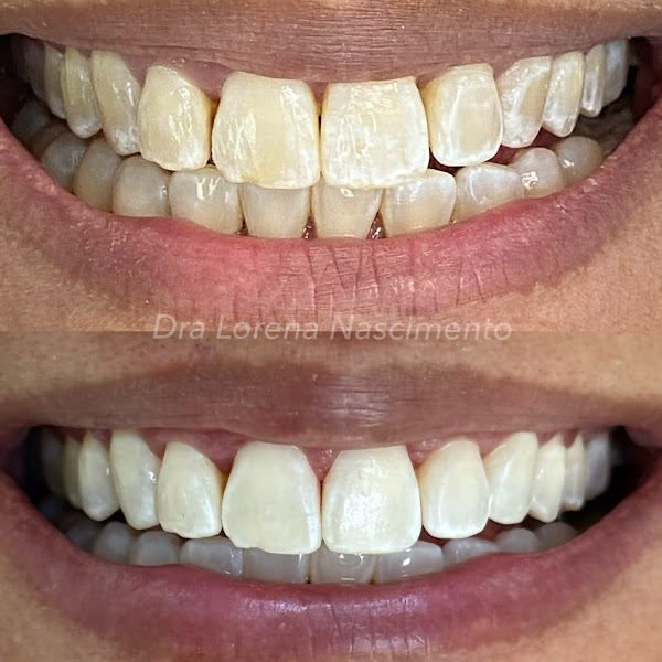 Foto 2 de Dra Lorena Nascimento Cirurgiã Dentista | Laranjeiras