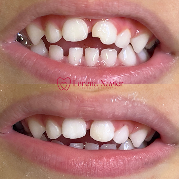 Foto 2 de Dra. Lorena Xavier - Odontopediatria - Castelo BH