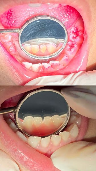 Foto 3 de Dra. Lorena Xavier - Odontopediatria - Castelo BH