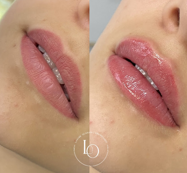 Foto 3 de Dra. Louyse Oliveira