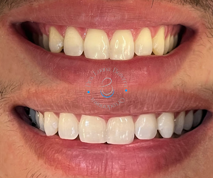 Foto 3 de Dra. Luana Bezerra, Invisalign