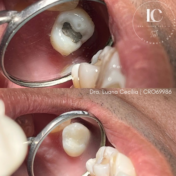 Foto 2 de Dra. Luana Cecília- Dentista Uberlândia