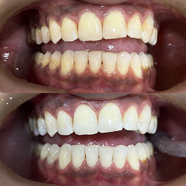 Foto 2 de Dra Luana Dutra | Cirurgiã-Dentista | Odontologia e Harmonização Orofacial