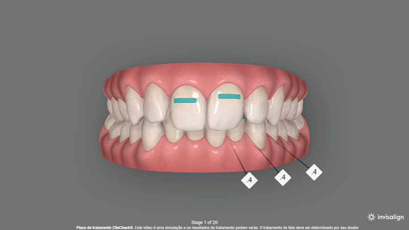 Foto 3 de Dra. Luana Pacheco Ortodontia