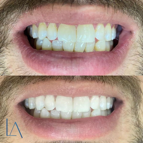 Foto 2 de Dra Luanda Ashley - PRÓTESE DENTÁRIA | ATENDIMENTO ODONTOLÓGICO DOMICILIAR | ODONTOLOGIA HOSPITALAR