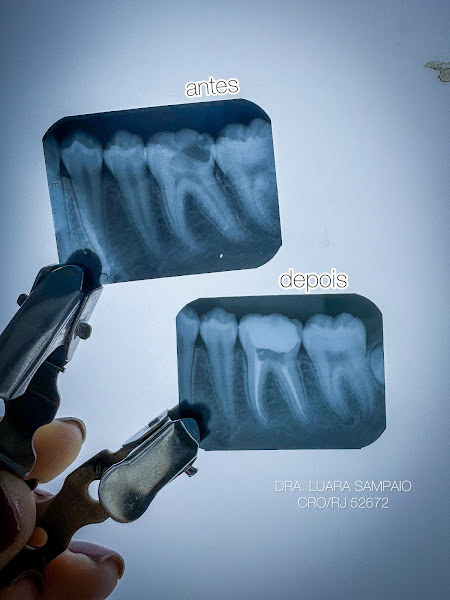 Foto 3 de Dra Luara Sampaio - Dentista em Nova Iguaçu