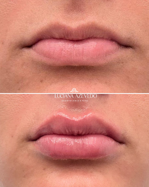 Foto 3 de Dra. Luciana Azevedo | Cirurgiã-Dentista