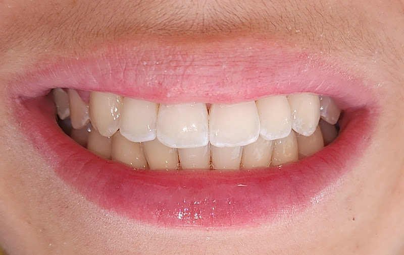 Foto 2 de Dra Luciana Belomo Yamaguchi - ORTODONTISTA - Ortodontia e Ortopedia Facial