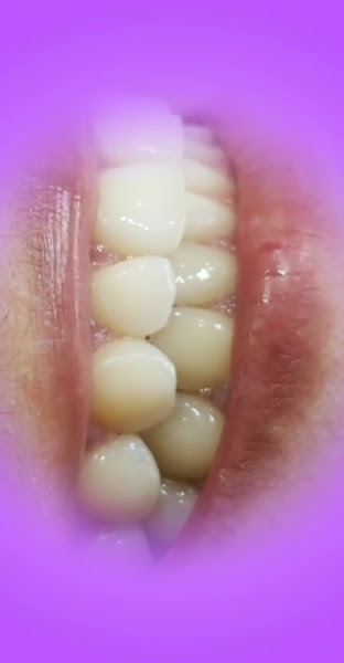 Foto 3 de Dra Luciana Bonfim Ortodontia Invisalign Doctor no Brooklin SP