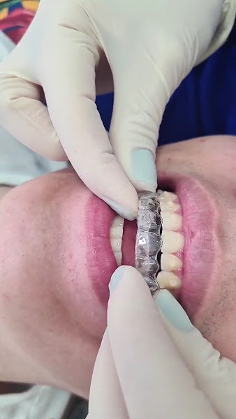 Foto 4 de Dra Luciana Bonfim Ortodontia Invisalign Doctor no Brooklin SP