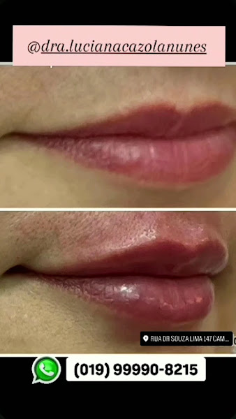 Foto 3 de Dra. Luciana Cazola Nunes