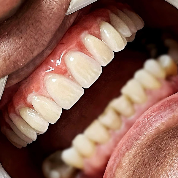 Foto 2 de Dra. Luciana Fortes - Cirurgia Sisos e Implantes