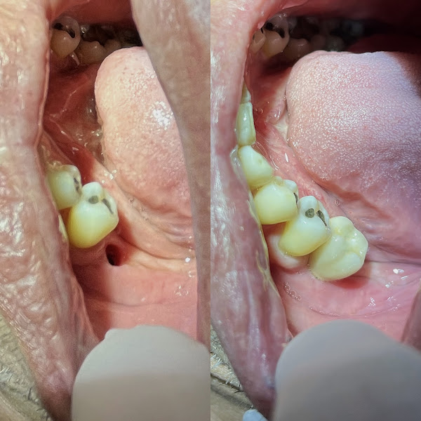 Foto 3 de Dra. Luciana Fortes - Cirurgia Sisos e Implantes