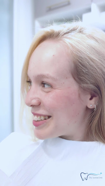 Foto 3 de Dra Luciana Lima | Dentista em Santana | Emergência | Siso | Implantes | Prótese Dentária