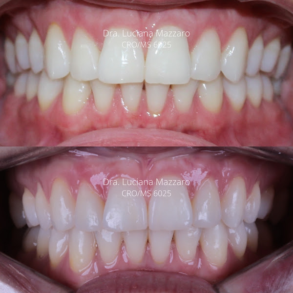 Foto 3 de Dra Luciana Mazzaro - Ortodontia/Invisalign