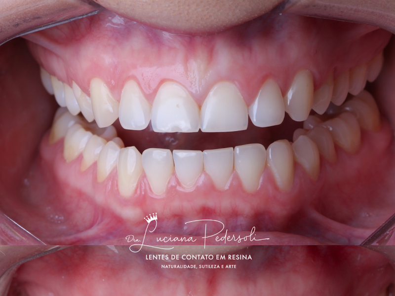 Foto de Dra. Luciana Pedersoli | Dentista especialista em Lentes de Resina em Belo Horizonte