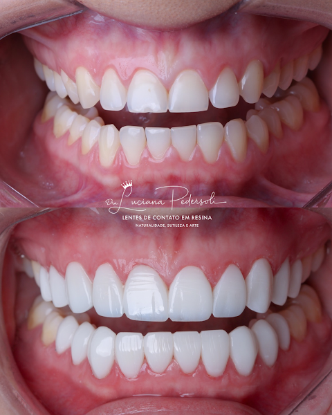 Foto 2 de Dra. Luciana Pedersoli | Dentista especialista em Lentes de Resina em Belo Horizonte