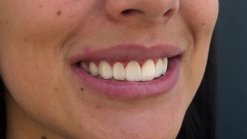 Foto 3 de Dra. Luciana Pedersoli | Dentista especialista em Lentes de Resina em Belo Horizonte