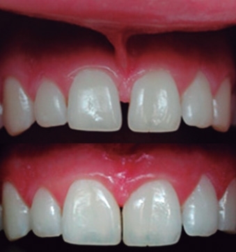 Foto 4 de Dra. Luciane Nobre Silva Ribeiro - Dentista, Prótese Dentária