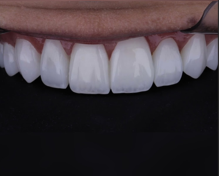 Foto 2 de Dra Luhara Carvalho - Dentista em Cuiabá