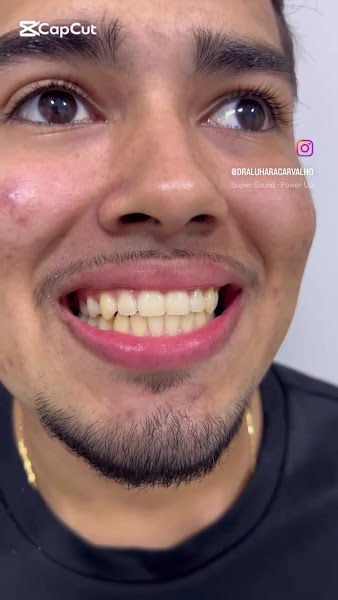 Foto 3 de Dra Luhara Carvalho - Dentista em Cuiabá