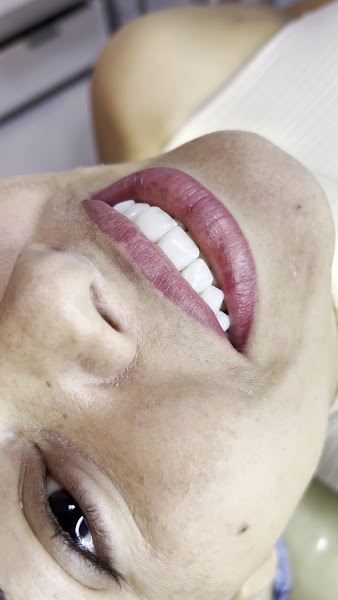 Foto 4 de Dra Luhara Carvalho - Dentista em Cuiabá