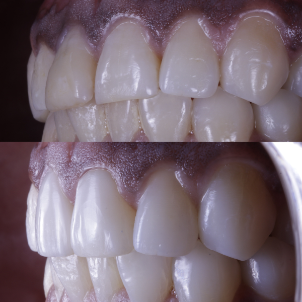 Foto 2 de Dra. Luiza Barcaui Odontologia