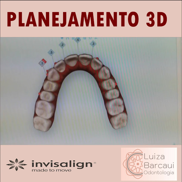 Foto 3 de Dra. Luiza Barcaui Odontologia