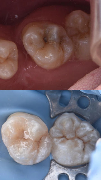 Foto 2 de Dra. Luiza Siqueira | Cirurgiã-Dentista