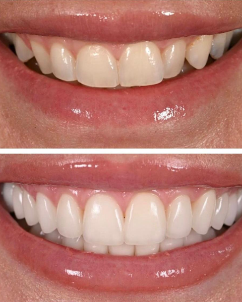 Foto 2 de Dra Lyllian Costa - Fábrica de Sorrisos