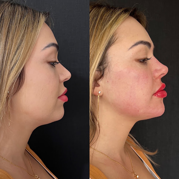 Foto 3 de DRA MADRID CLINIC - HARMONIZAÇÃO FACIAL E ESTÉTICA AVANÇADA