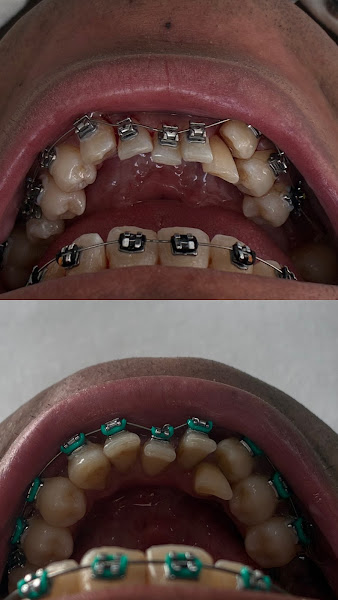 Foto 2 de Dra Maiara Farias - Consultório odontológico