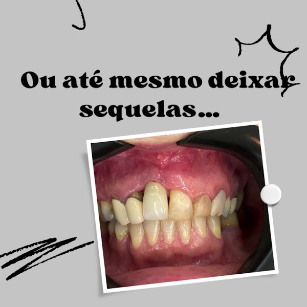 Foto 3 de Dra. Mairaira Leão (Periodontista e Implantodontista).