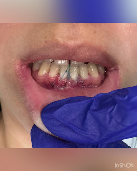 Foto 4 de Dra. Mairaira Leão (Periodontista e Implantodontista).