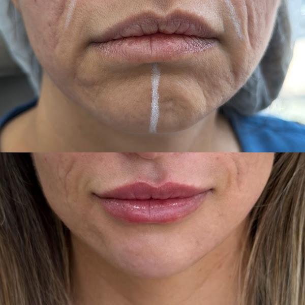 Foto 3 de Dra. Manu Barcelos - Referência em Rejuvenescimento Facial