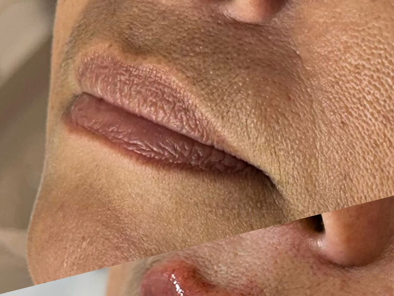 Foto de Dra. Manuella Macena - Harmonização Facial