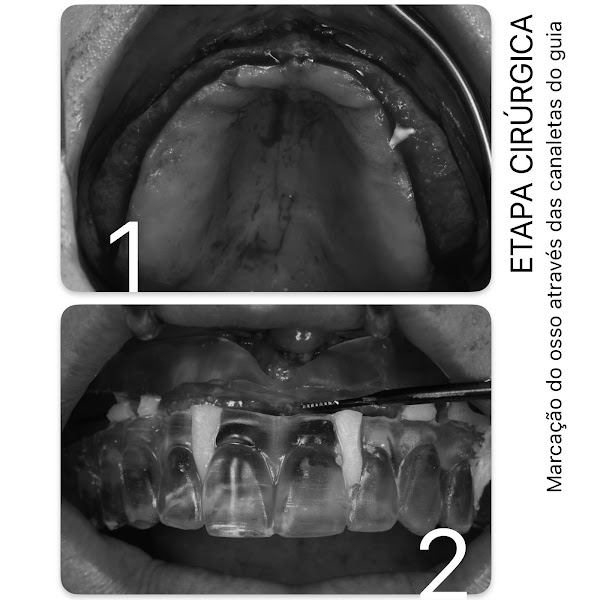 Foto 3 de Dra. Marcela Fróes | Implantes dentários no Rio de Janeiro